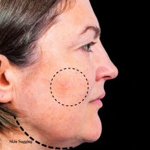 Before — -Cassandra, 56