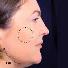 After — -Cassandra, 56